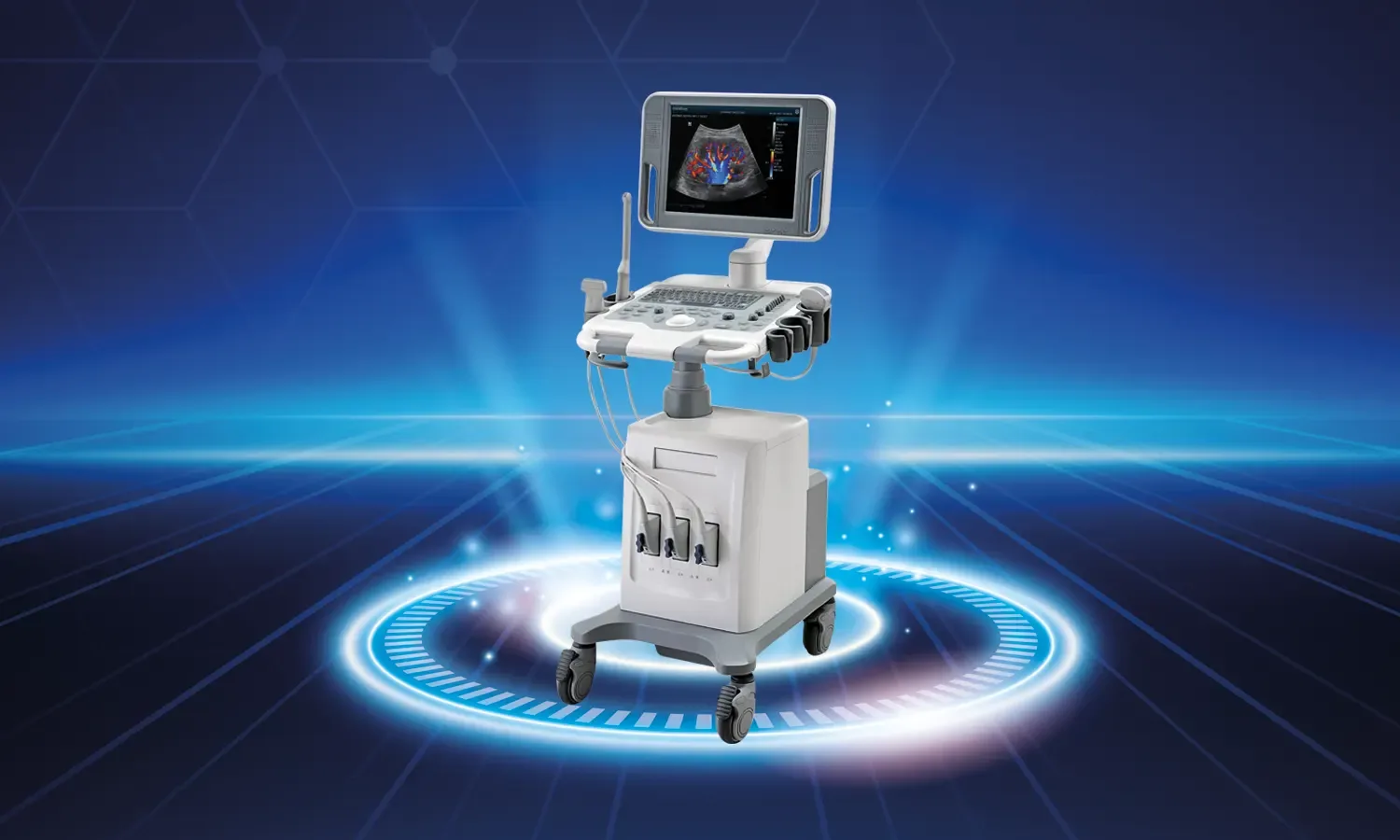 İleri Düzey Ultrasonografi Ve Fetal Tedavi