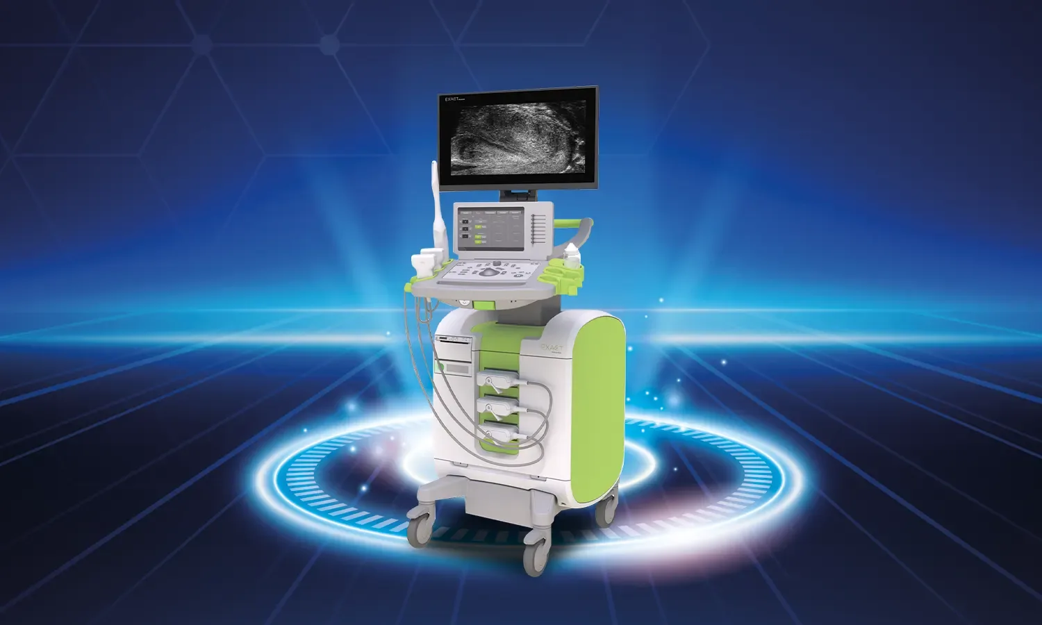 Mikro Ultrason Füzyon Biyopsi