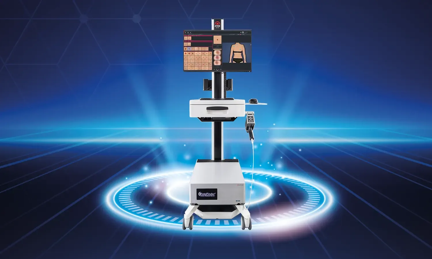 Bilgisayarlı Dermoskopi