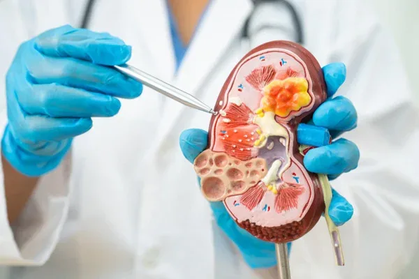Nefroloji