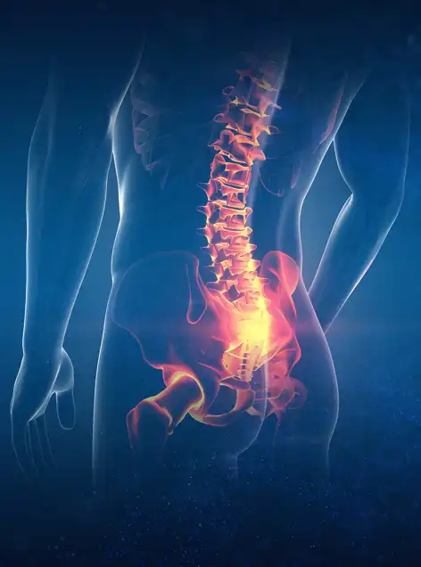 Non-Surgical Herniated Disc Treatment