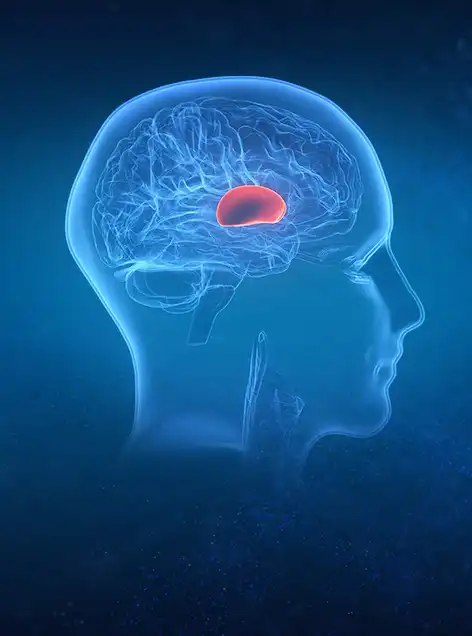Gamma Knife Treatment for Brain Tumors