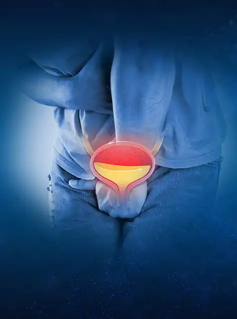 Bladder Cancer Treatment