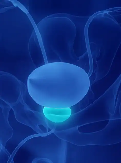 Thulium Laser (ThuLEP) in Prostate Treatment