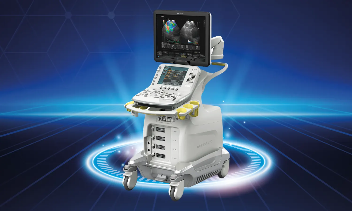 Endoskopik Ultrasonografi (EUS)