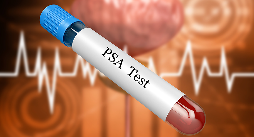 Men’s Nightmare: Increase In Psa (Prostate Specific Antigen) And Prostate Cancer