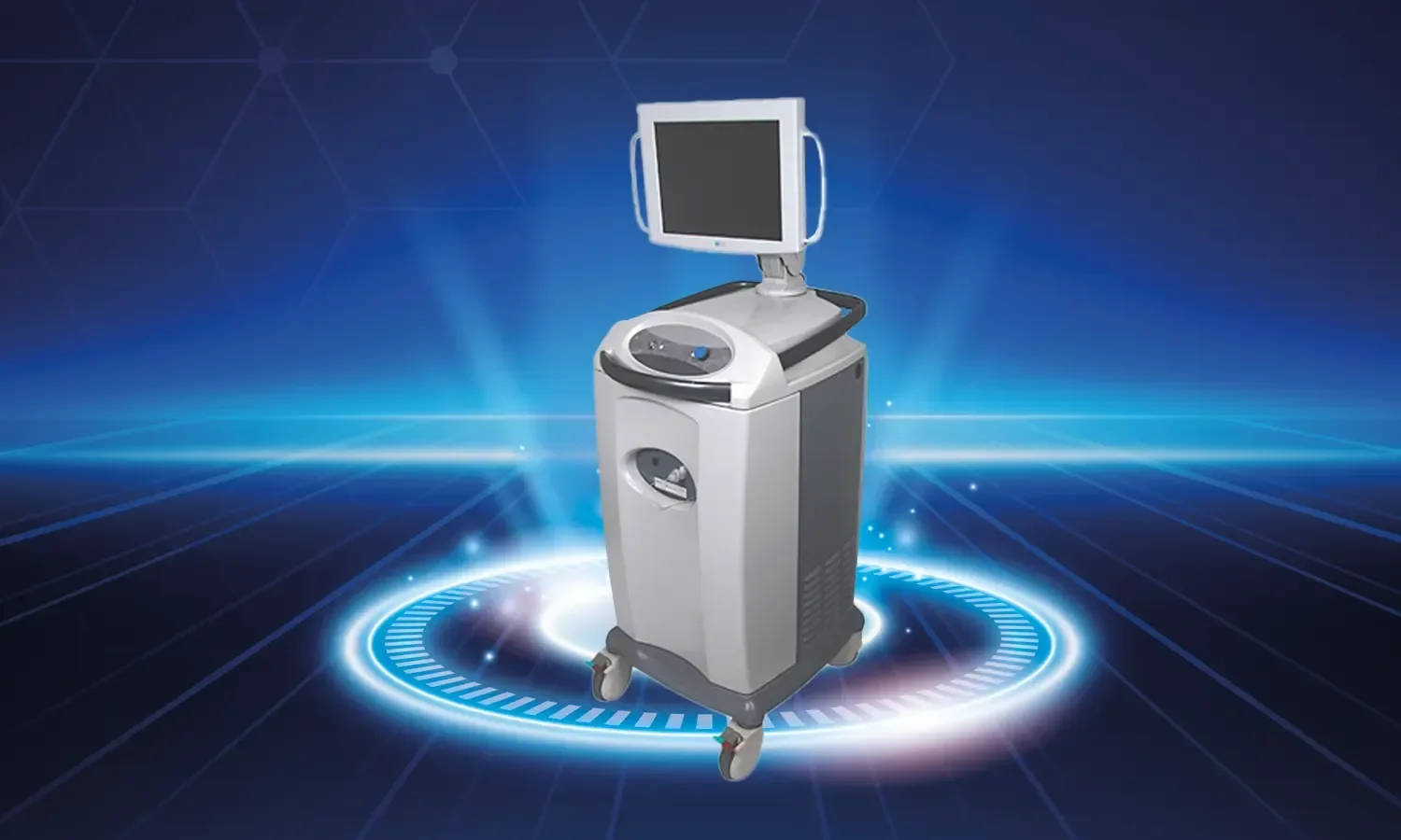 Atriyal Fibrilasyon Tedavisinde Cryoablasyon